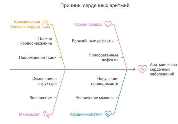 причины сердечной аретмии